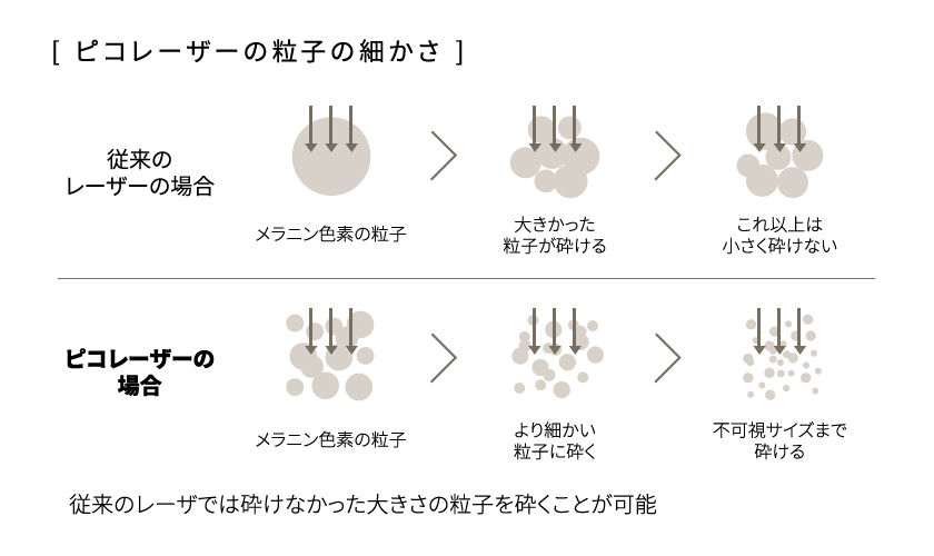 ピコレーザーの粒子の細かさ