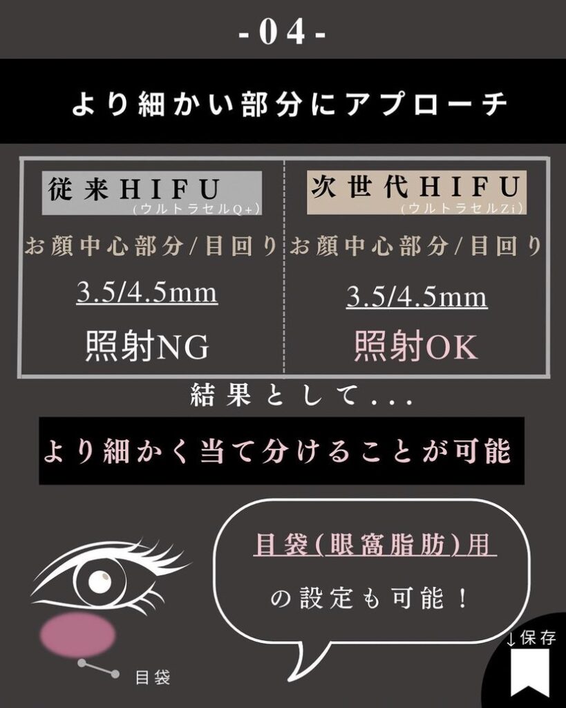 カスタマイズハイフ