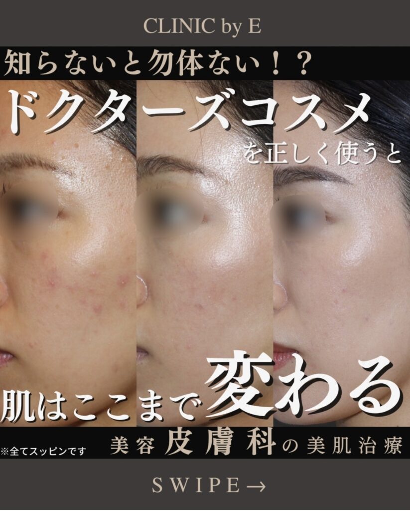 ドクターズコスメ