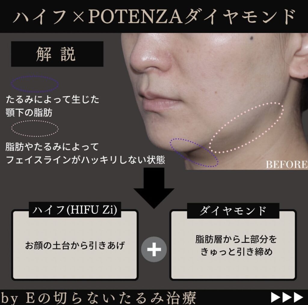 ハイフPOTENZAダイヤ