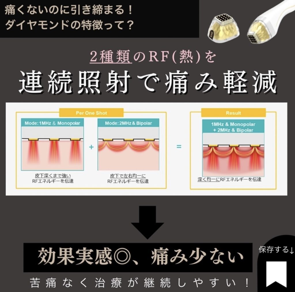 ポテンツァダイヤモンド