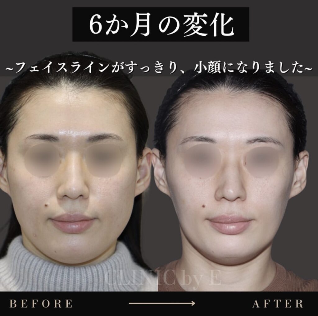 カスタマイズ治療