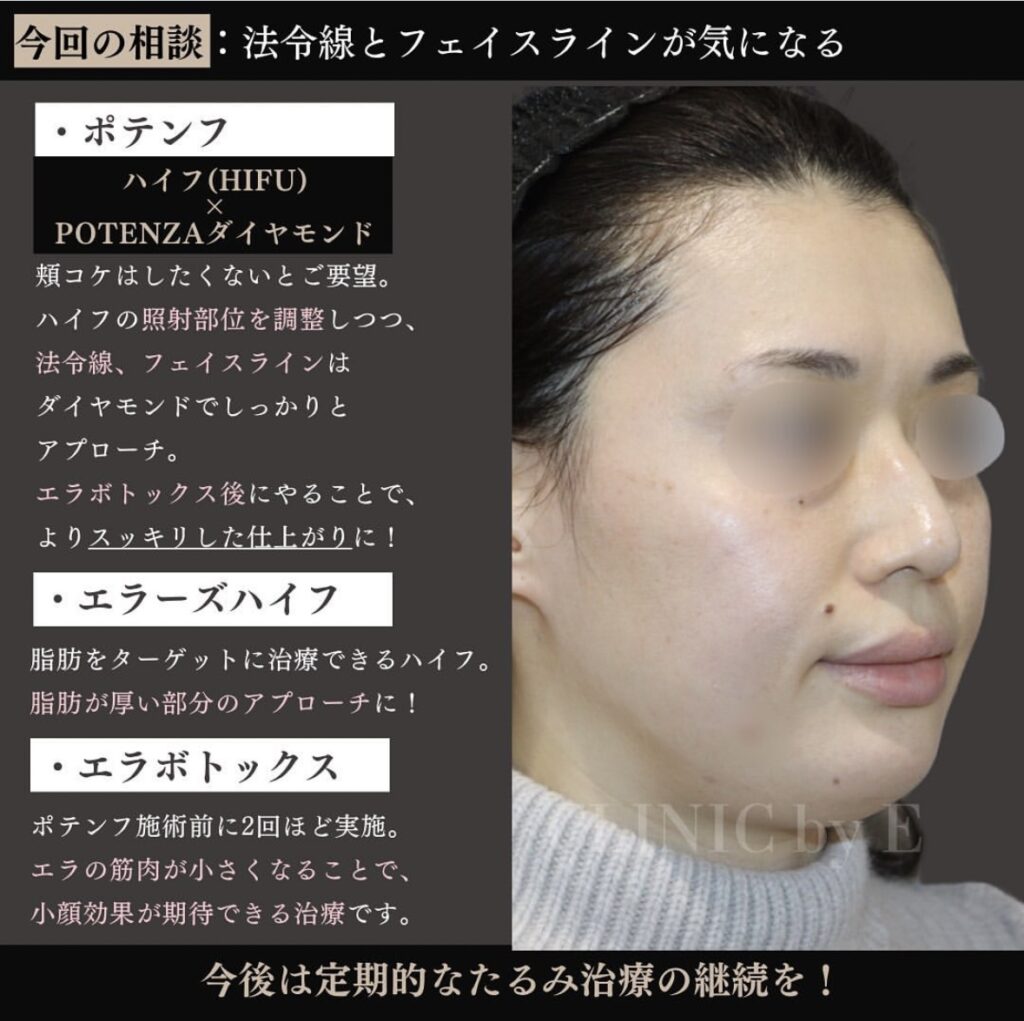 ポテンザダイヤモンド