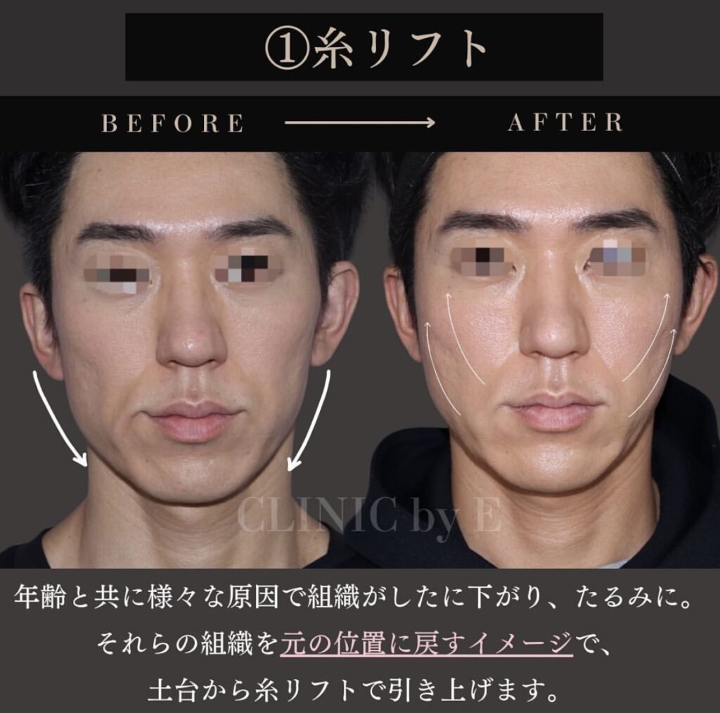 ショッピングリフト