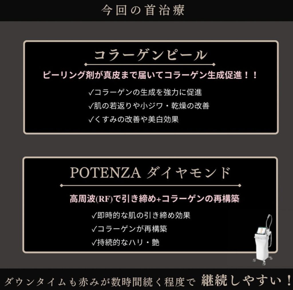 ポテンザダイヤモンド