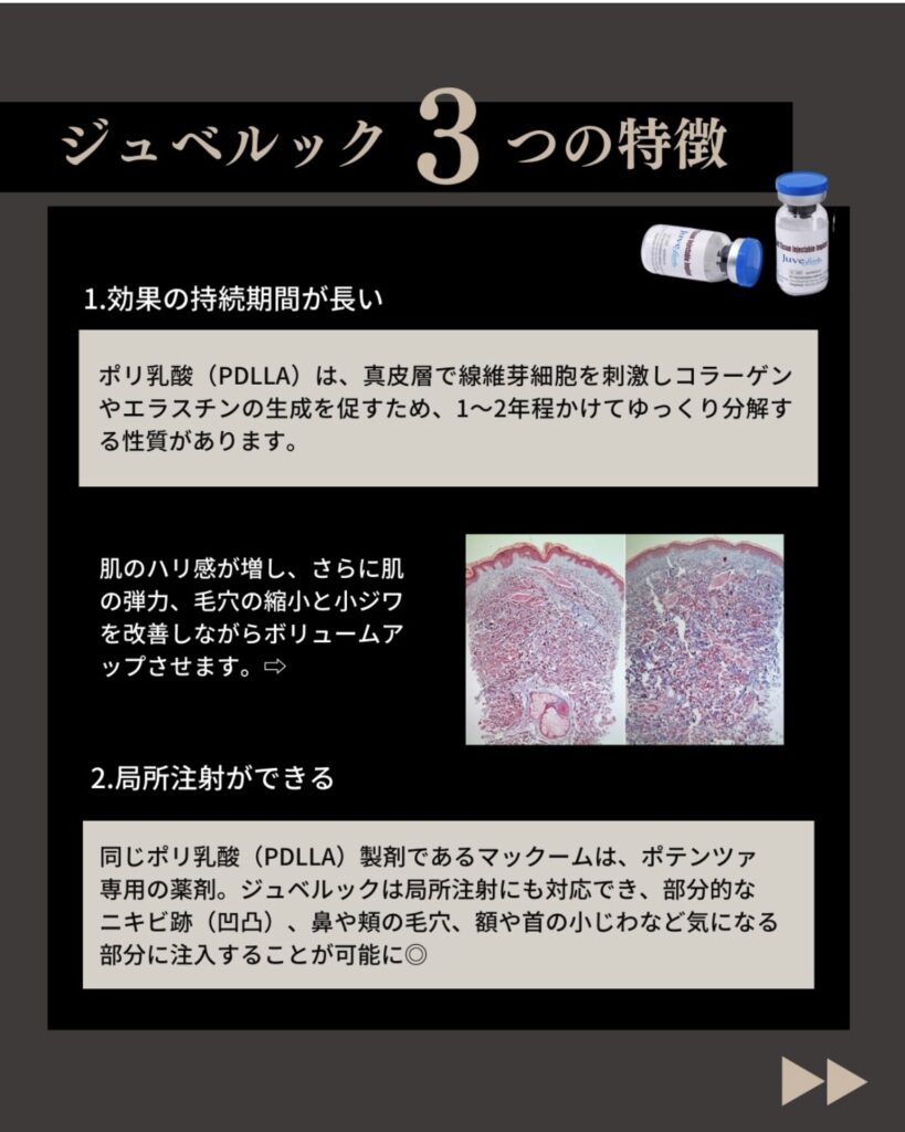 スキンブースター治療