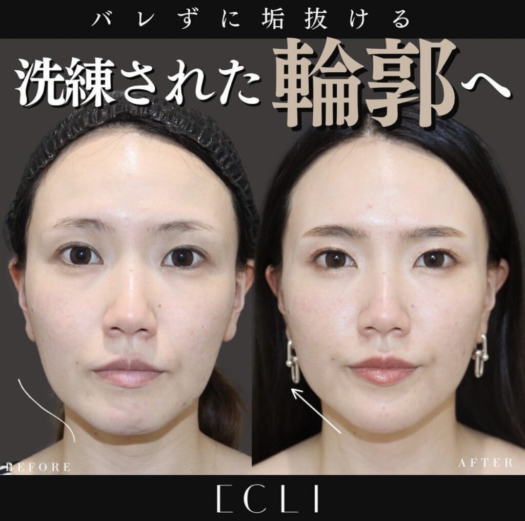 洗練された輪郭