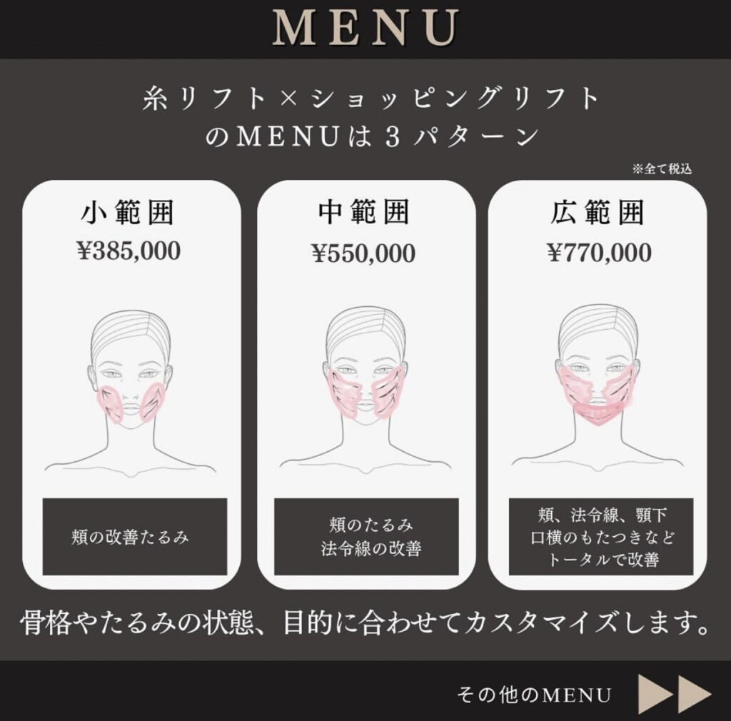 糸リフトショッピングリフト