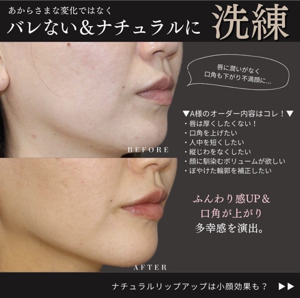 ばれないナチュラル治療