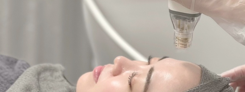 ポテンツァのダウンタイムはどう過ごす？症状・期間・経過・術後ケアを紹介